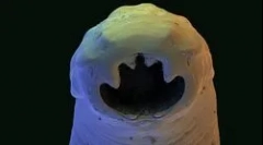 Cum să scapi de viermi